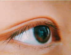 倒睫是由什么原因引起的？